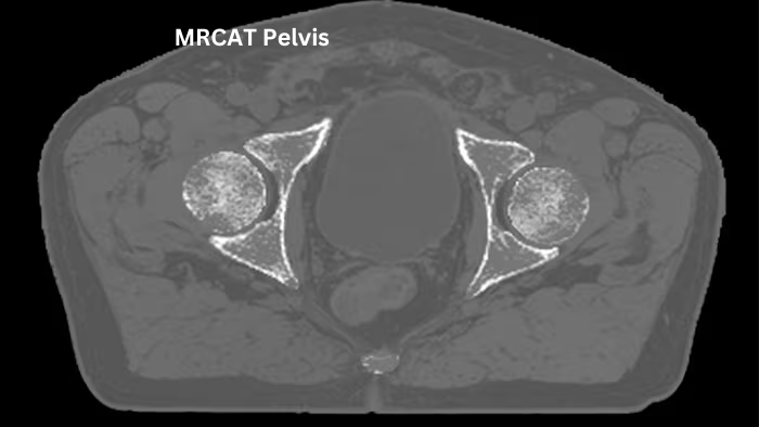 MRCAT Pelvis